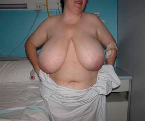 Reducción de mamas