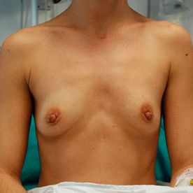 Aumento y reducción de mamas