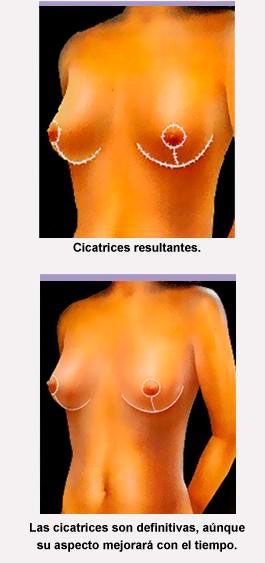 Cicatrices resultantes 