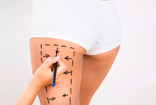 Piernas con trazos 